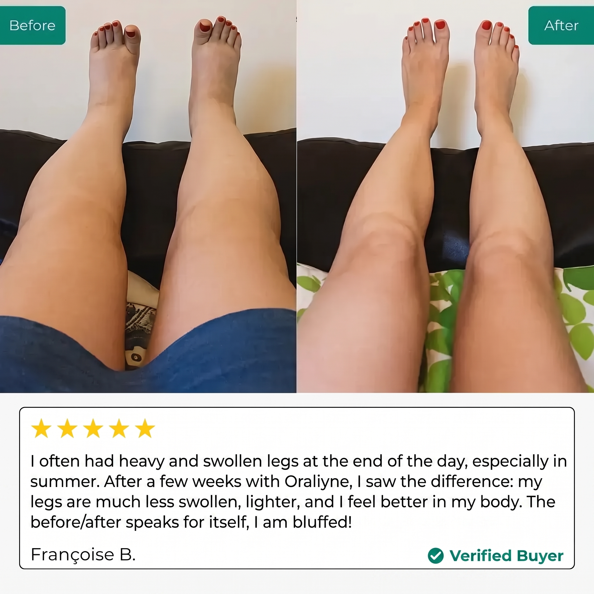 Oraliyne — Lymphatic Drainage Drops